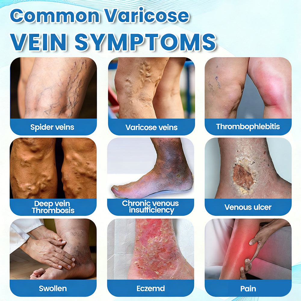 🇨🇦✨✨GFOUK® VascuCare Vein Healing Spray(Designed for Varicose veins, Spider veins, Deep vein Thrombosis, Chronic venous insufficiency, Venous ulcers, Thrombophlebitis and other venous issues)