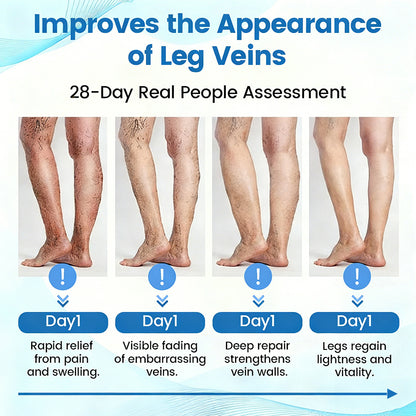🇨🇦✨✨GFOUK® VascuCare Vein Healing Spray(Designed for Varicose veins, Spider veins, Deep vein Thrombosis, Chronic venous insufficiency, Venous ulcers, Thrombophlebitis and other venous issues)