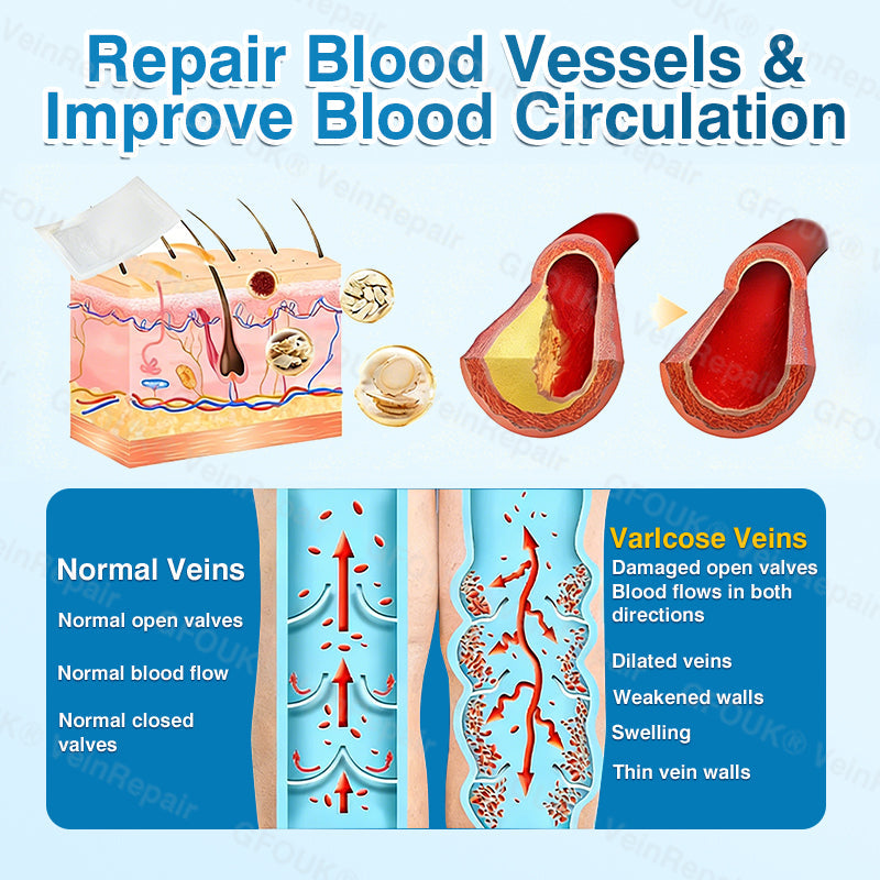 🇨🇦🏆✅️🏃GFOUK® VeinRepair Microneedle Patch Roll⚡Instant Relief, Long-Term Results