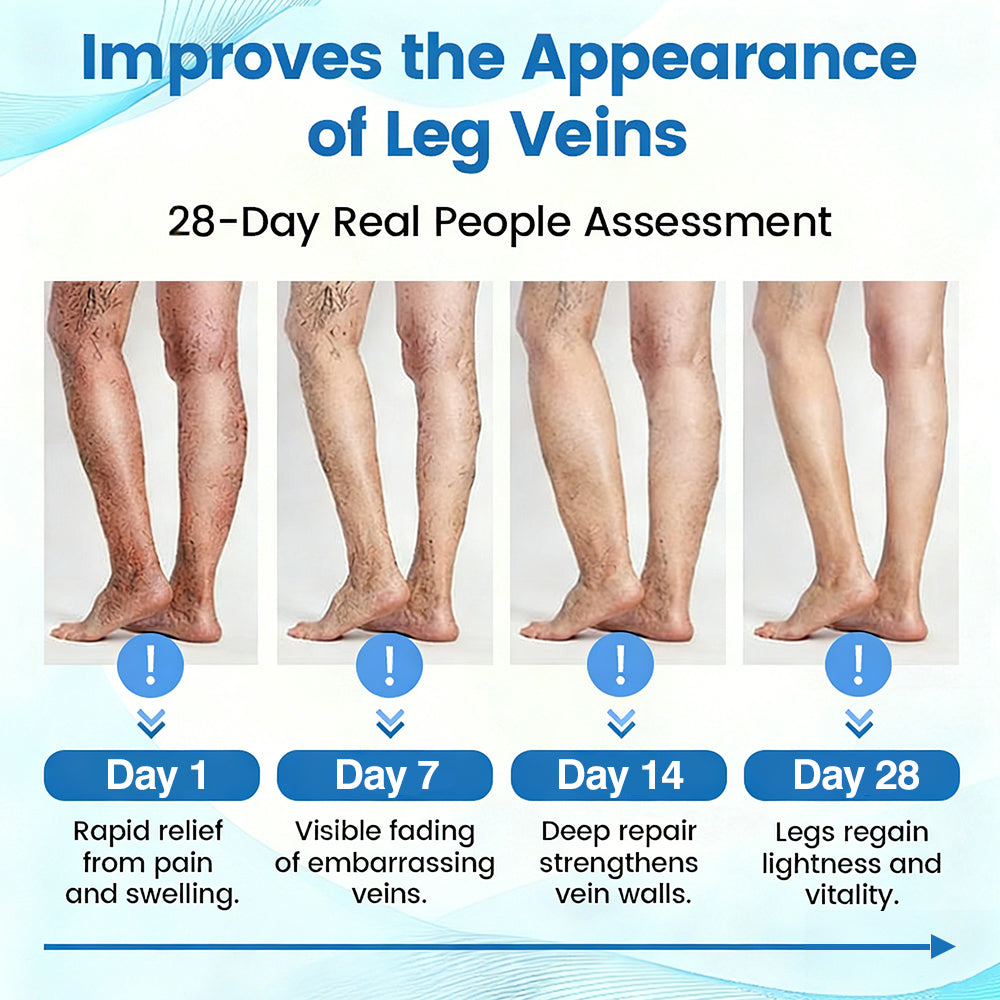 🇨🇦🏆✅🌿GFOUK® VascuCare Vein Healing Spray(Designed for Varicose veins, Spider veins, Deep vein Thrombosis, Chronic venous insufficiency, Venous ulcers, Thrombophlebitis and other venous issues)